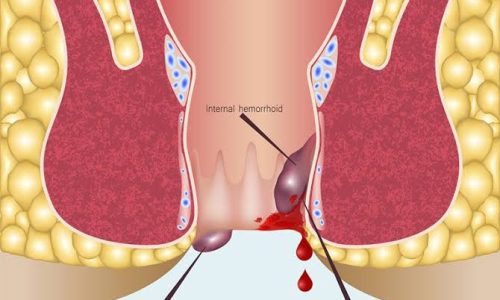 D1334AAA-28B3-454A-9949-A741296B796C